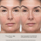 THERABODY Thera Face Wellness Gadget/Device